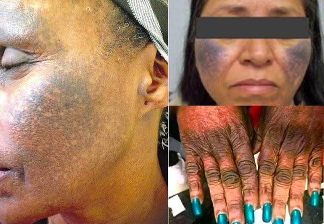 See The Health dangers Of Using Bleaching Cream And Why You Should Avoid Bleaching Your Skin